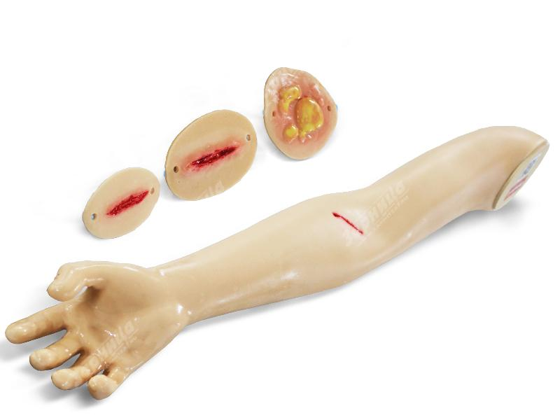 Phantom hand for applying and removing sutures, treating burns and wounds Zarnitza