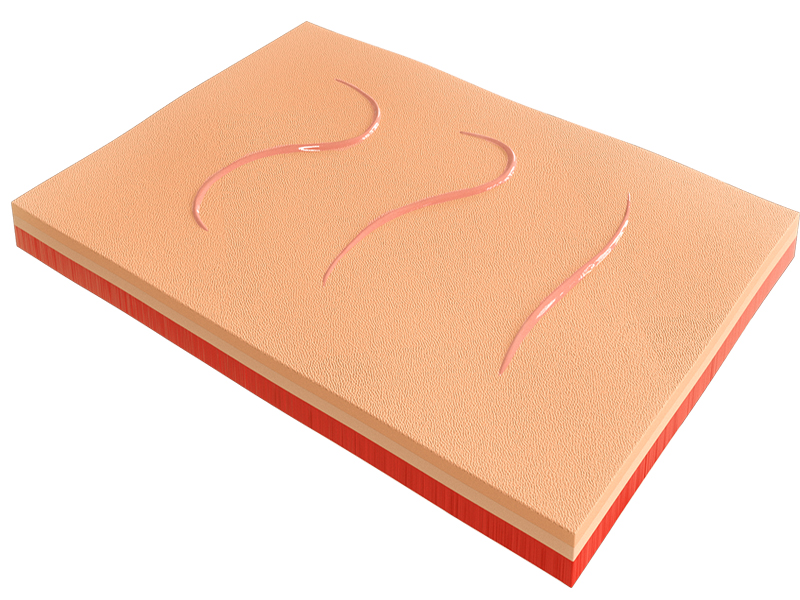Set of consumables for the Zarnitza TSSH-1.01 MU0236 surgical suture removal simulator