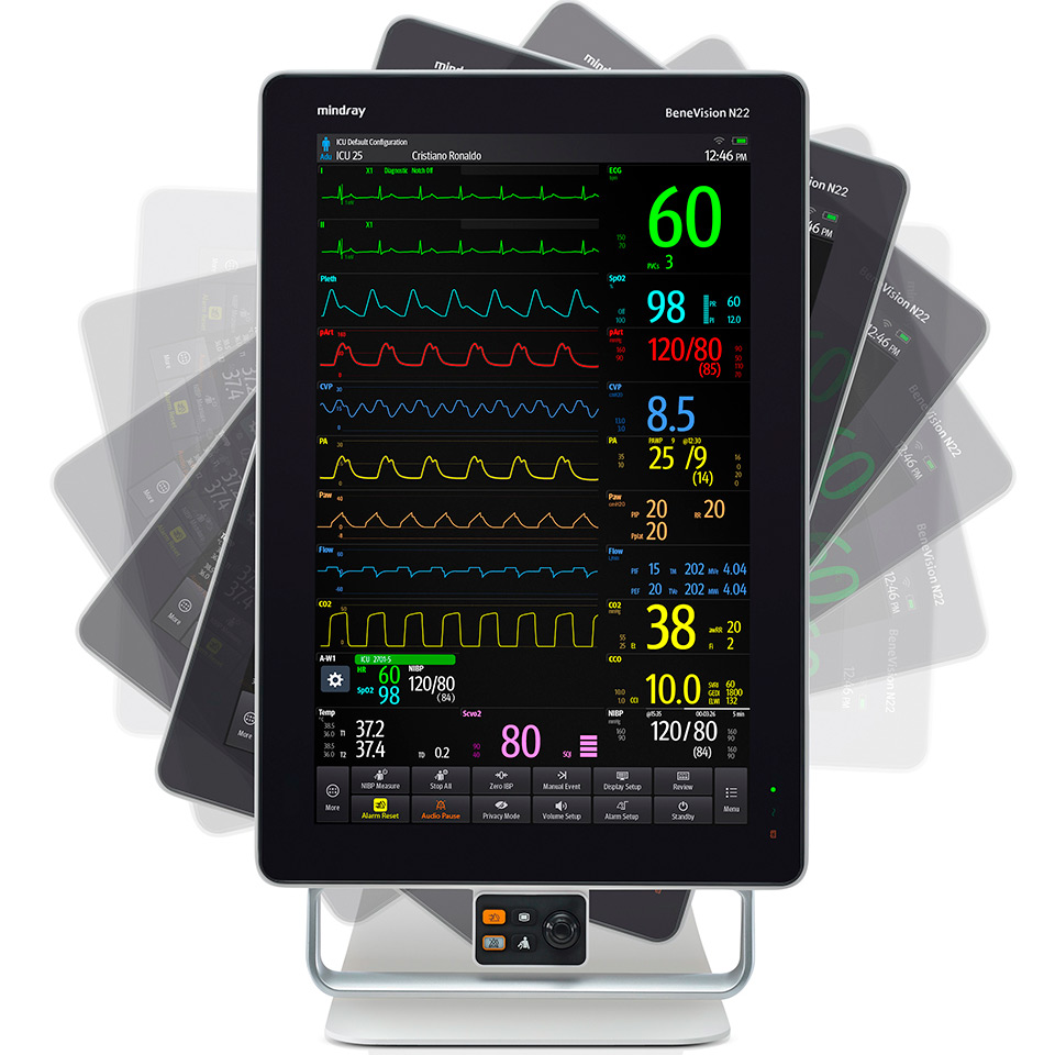 Mindray BeneVision N19 patient monitor