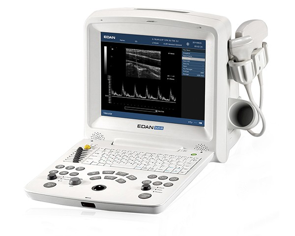 Ultrasound scanner DUS 60