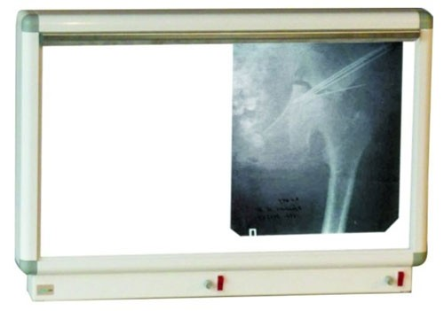 X-ray viewer NM-1
